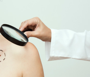 Péče o pokožku po radioterapii