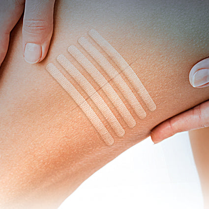 Eurosuture zpevněné náplasťové stehy